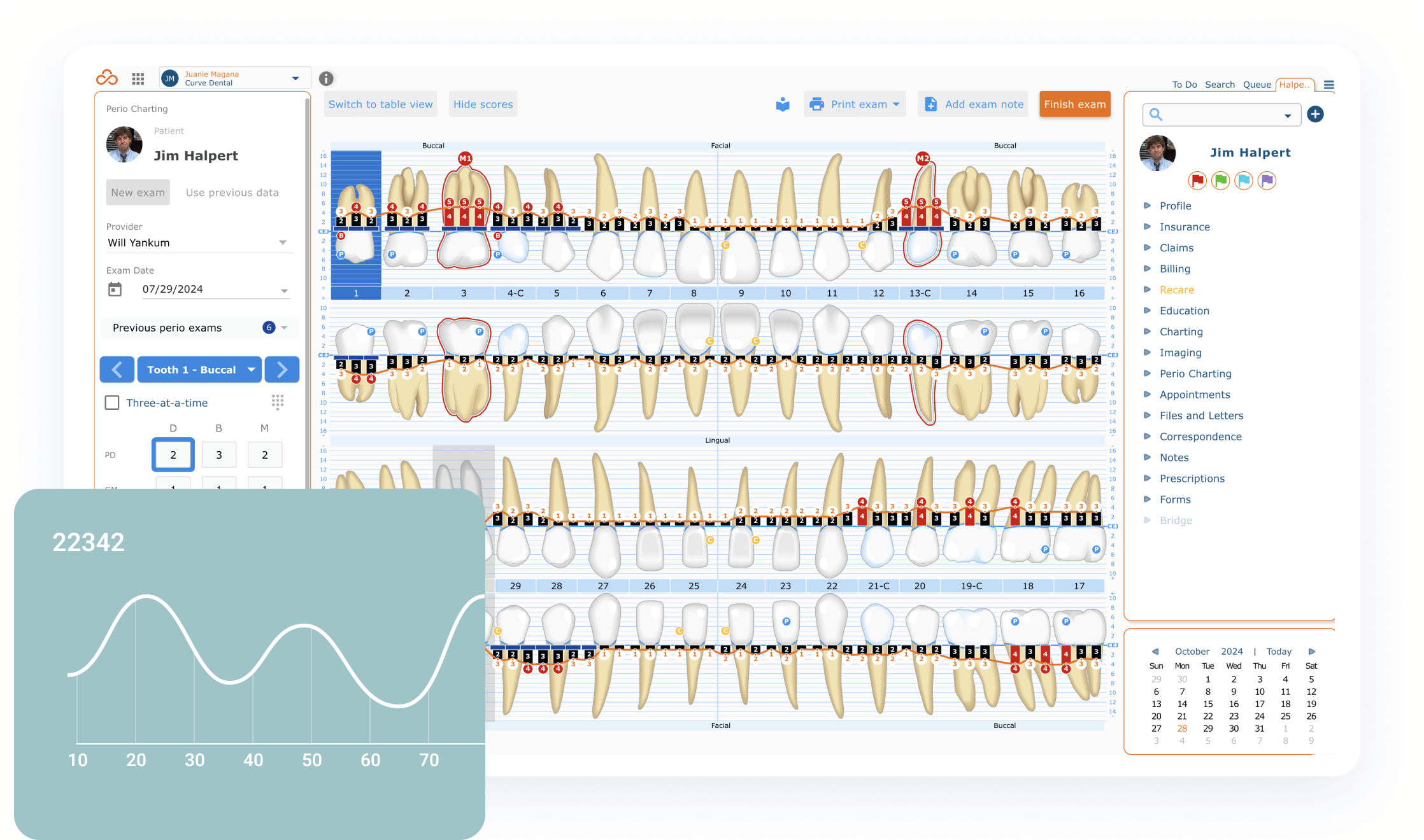 Curve Dental Efficient Perio Charting
